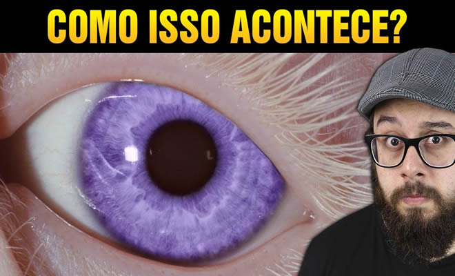 O Raro Caso Dos Olhos Violeta Como Isso Acontece Tediado